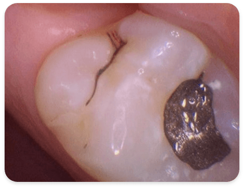 Smile Gallery - Case 1 - Before