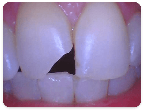 Smile Gallery - Case 2 - Before