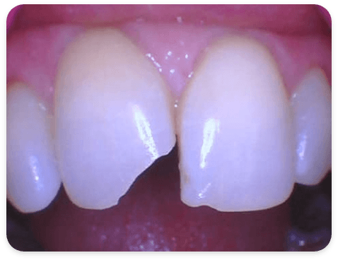 Smile Gallery - Case 3 - Before